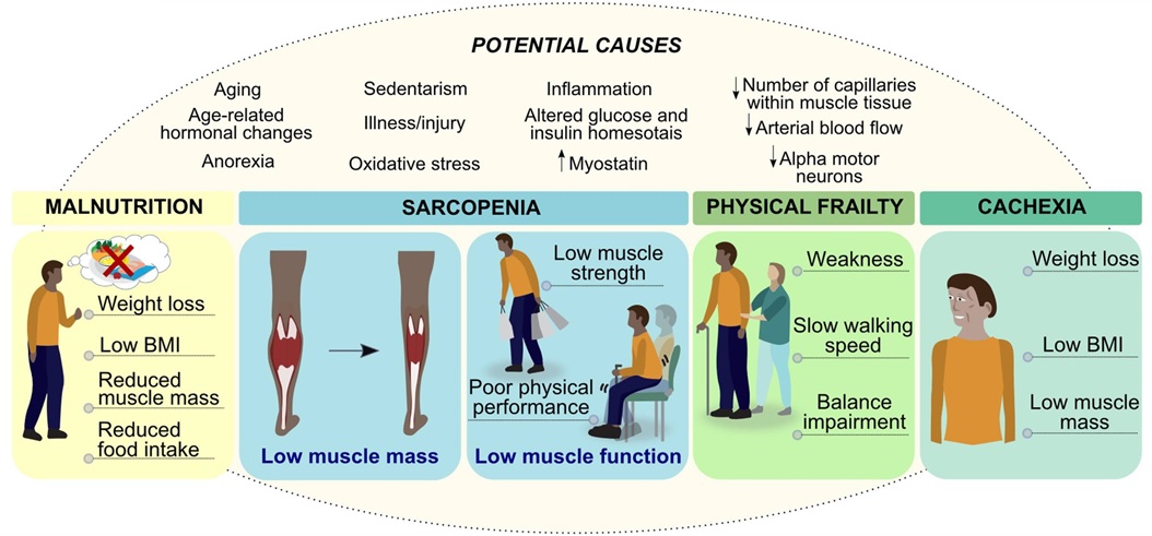 Salud muscular y nutrición - Artículos - IntraMed