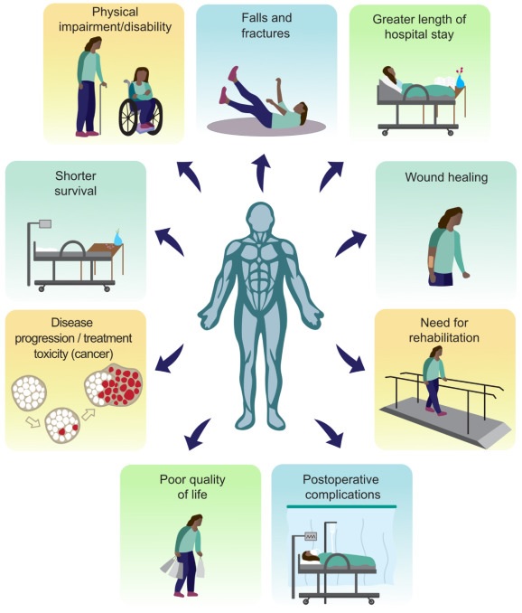 Exercícios para Um Envelhecimento Saudável, PDF, Músculo esquelético
