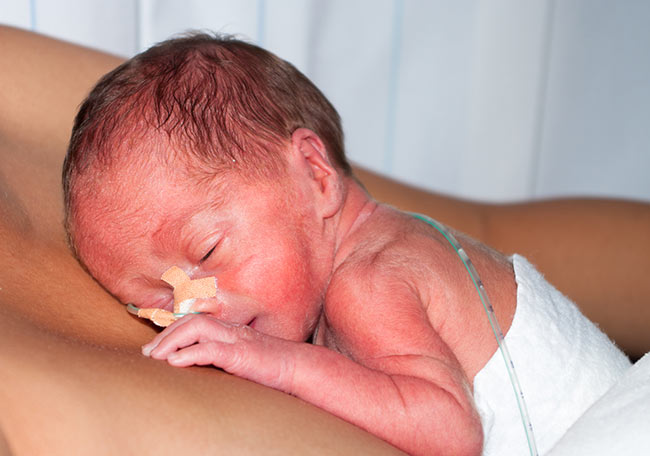 Cómo cuidar de la piel del recién nacido