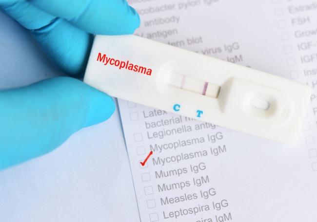 Mycoplasma Genitalia. A Mycoplasma Genitalium-betegség beltéri fertőzése és kezelése