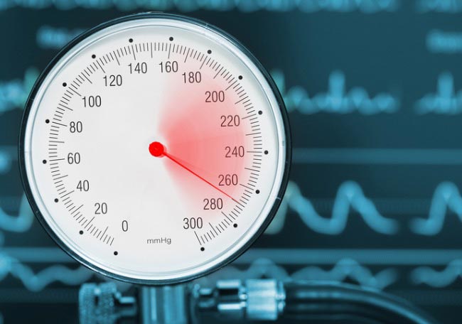 Monitoreo ambulatorio de la presión arterial - Artículos - IntraMed