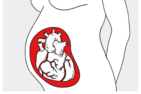 Si ha sufrido varios abortos espontáneos, vigile su corazón - Noticias  médicas - IntraMed
