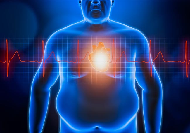 Exceso de barriga y riesgo cardiovascular